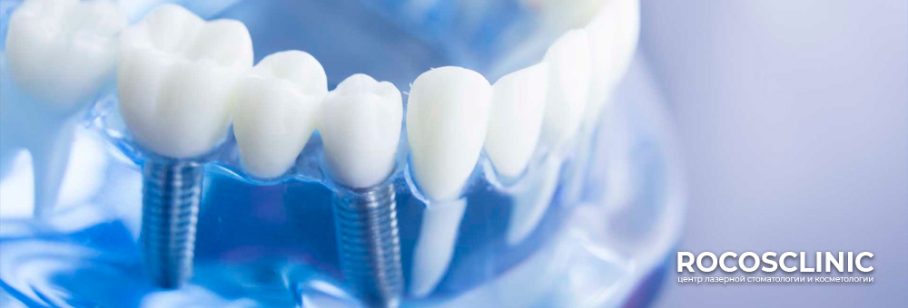 Несъёмное протезирование зубов